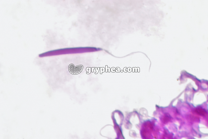 Grenouille - Spermatozoïde isolé x600 - gryphea.com